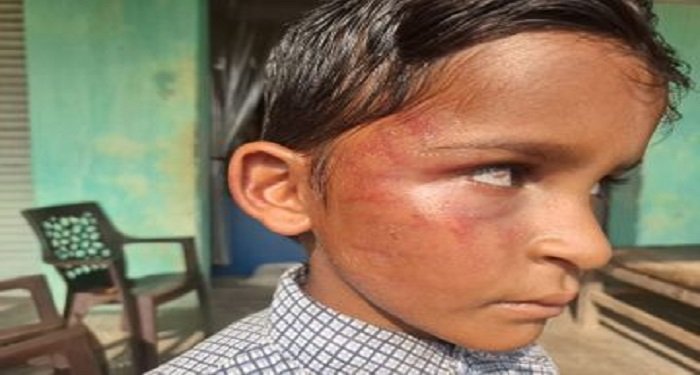 मासूम छात्र की पिटाई का मामला: प्रधान पाठक निलंबित, जांच हुई तेज